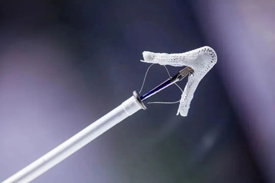 二尖瓣返流治疗器械